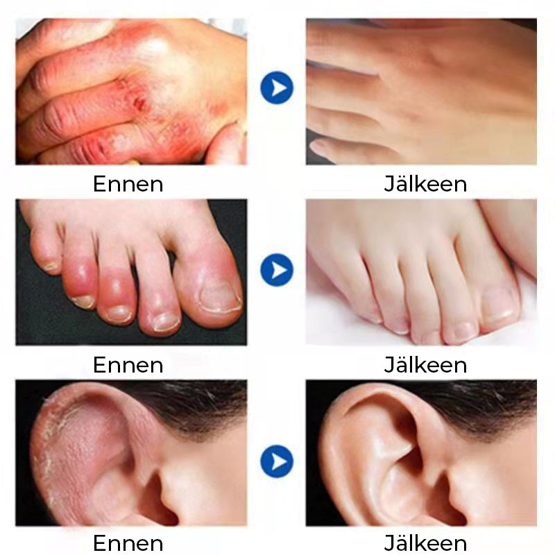 Speciel fugtgivende beskyttende creme til frostvejr i hvid krukke, 80ml, til beskyttelse af hud mod kulde og revner.
