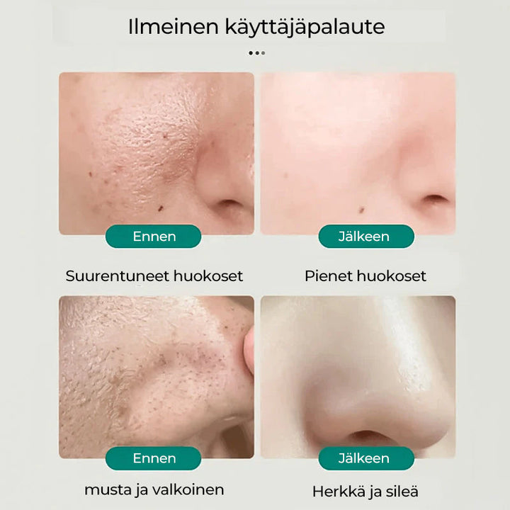 Lysnende ansigtsrens, hvid tube med grønne detaljer, velegnet til alle hudtyper.