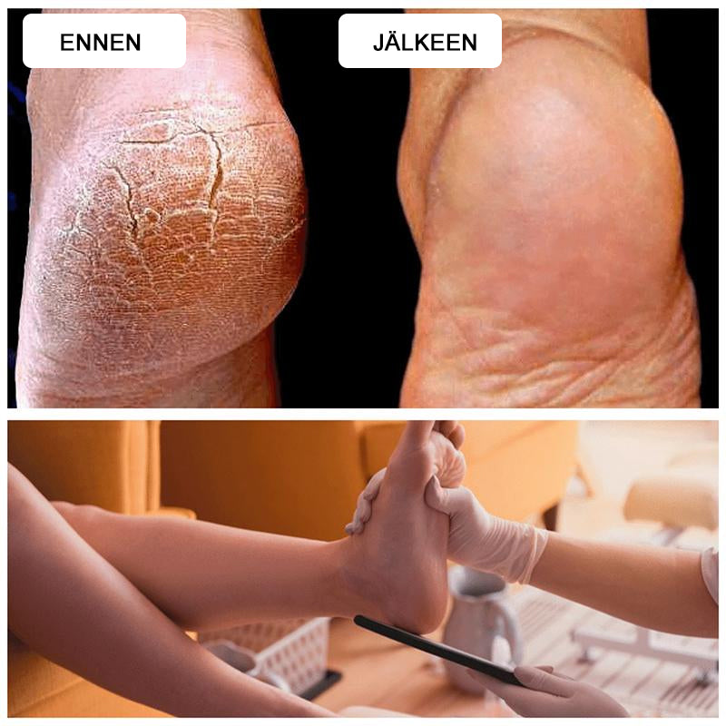 Dame pedi-fodrasp med metaloverflade, ergonomisk håndtag, fjerner hård hud, sølvfarvet, skønhedspleje