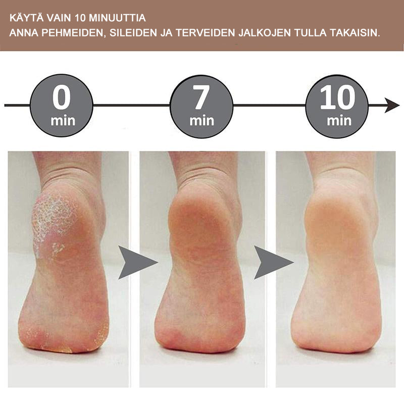 Dame pedi-fodrasp med metaloverflade, ergonomisk håndtag, fjerner hård hud, sølvfarvet, skønhedspleje
