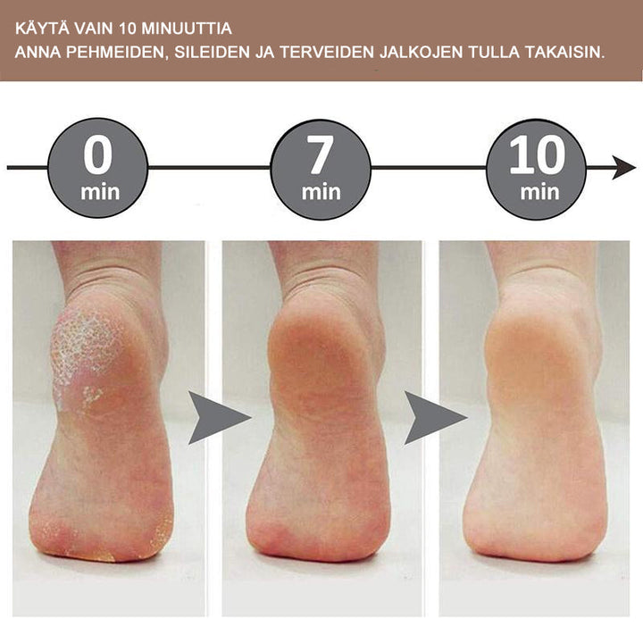 Dame pedi-fodrasp med metaloverflade, ergonomisk håndtag, fjerner hård hud, sølvfarvet, skønhedspleje