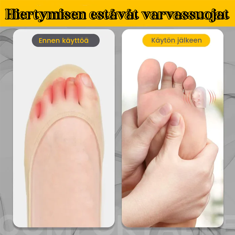Silikone gennemsigtige tåbeskyttere, unisex, tåbeskyttelse og komfort, medicinsk silikone, pakker med 2/10 stk.