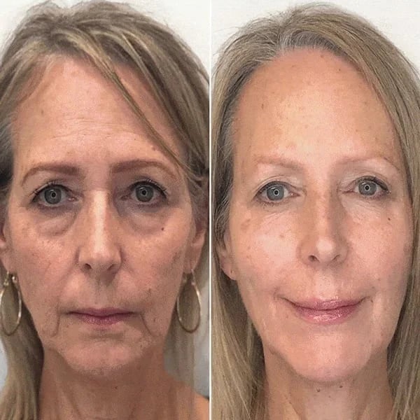 Anti-age serum i elegant flaske. Giver ansigtet vitalitet og reducerer synlige rynker.