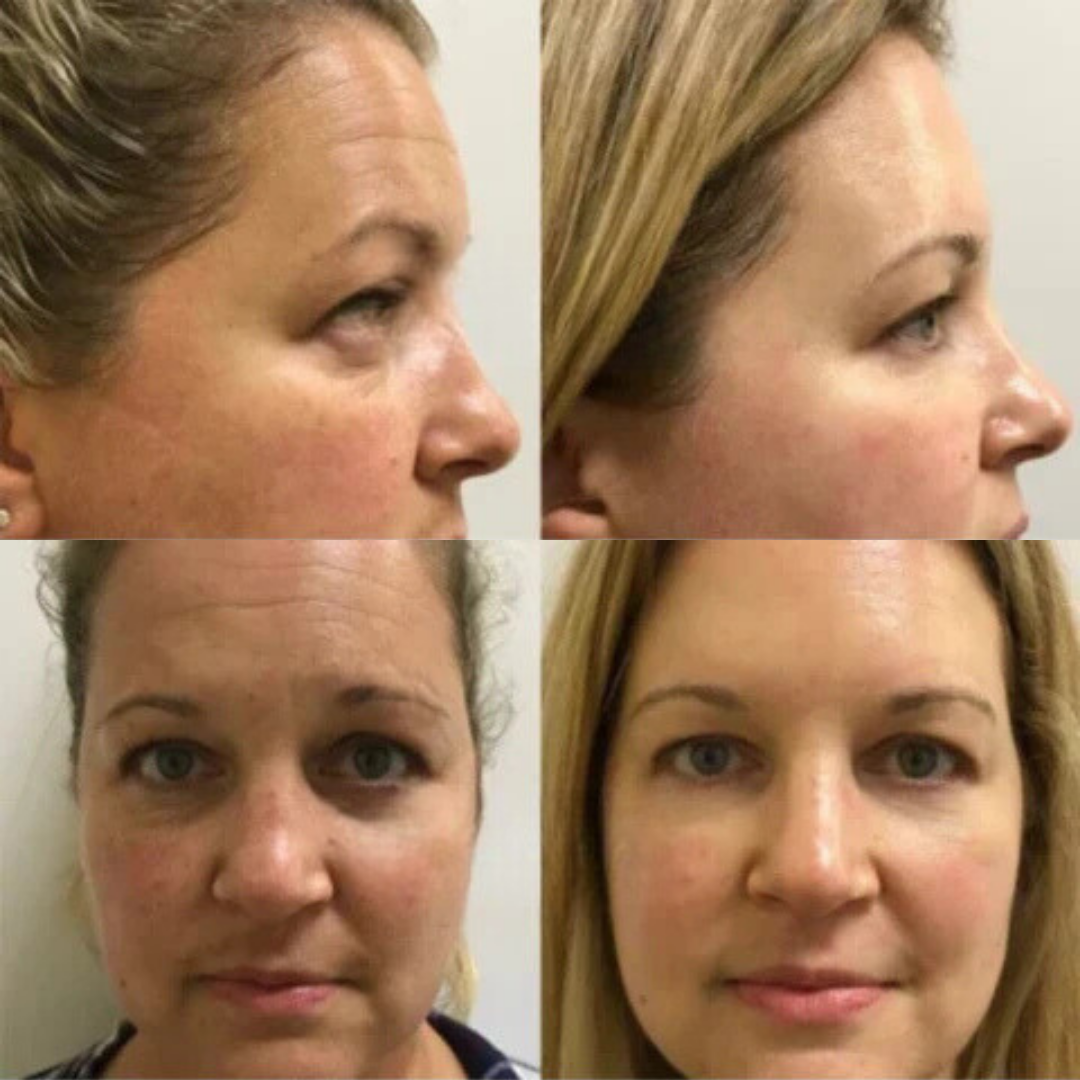 Intensivt anti-age serum. Til bekæmpelse af rynker og fremme af en sund, strålende hud.