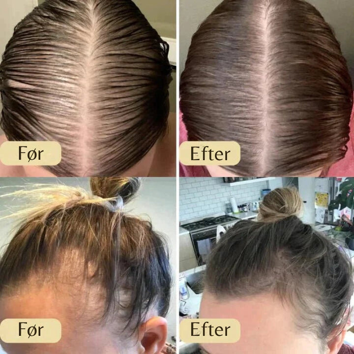 Unisex hårvækstolie der nærer hovedbunden og styrker håret. Forhindrer hårtab og giver naturligt fyldigere, sundere hår.