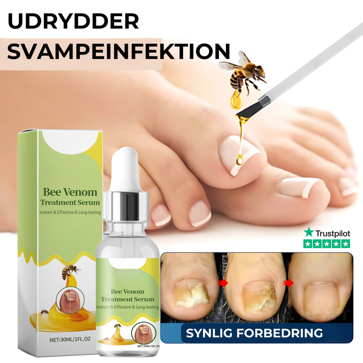 Negleskjold neglesvamp serum til effektiv behandling af neglesvamp for sunde og stærke negle.