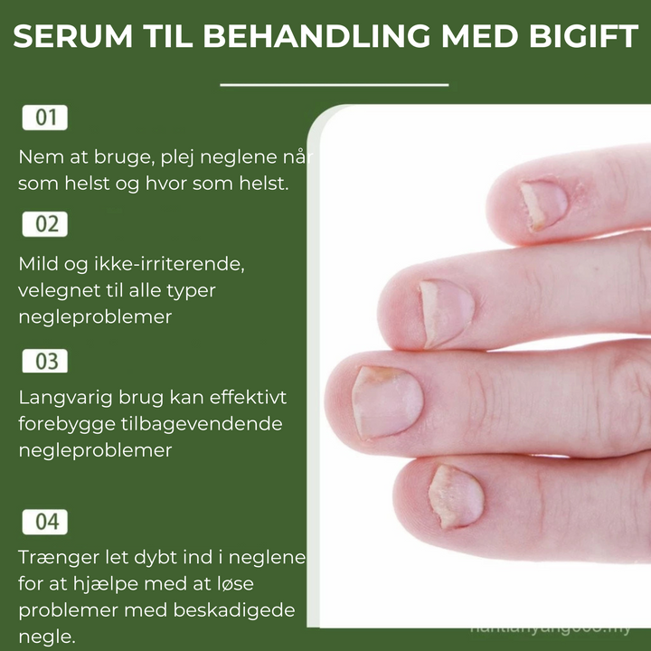 Avanceret neglepleje med Negleskjold serum. Behandler neglesvamp og øger neglenes naturlige styrke.